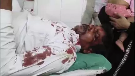 पुवायां: सड़क हादसे में एक बाइक सवार गंभीर घायल, सरकारी अस्पताल में चल रहा है इलाज, संजय नगर का मामला