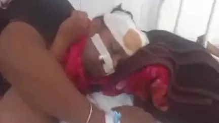 बारां: एन एच 27 समरानिया के पास बाइक अनियंत्रित होकर डिवाइडर से टकराई, एक युवक घायल, जिला अस्पताल में भर्ती