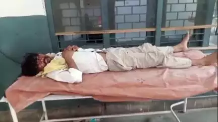 हसनपुर: सैदनगली गांव चमर पतेई में बंदरों के झुंड ने युवक पर किया हमला, युवक की हालत गंभीर