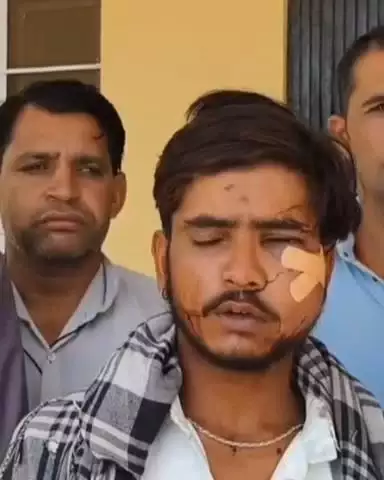 जयपुर: कालाडेरा इलाके में चौकीदार के टोकने पर चोरों ने किया चौकीदार पर हमला