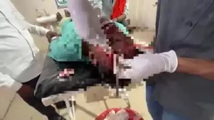 टीकमगढ़: मजना गांव के पास सड़क हादसे में तीन घायल, एक गंभीर, ज़िला अस्पताल में भर्ती