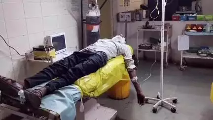कटनी नगर: कटनी: इंद्रा ज्योति कॉलोनी में शादी में भोजन कर रहे लोगों पर लाठी-डंडों से हमला, 2 घायल