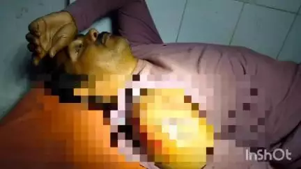 हरचोका में डकैतों का कहर, ब्रह्मा सोनी को मारी गोली, सोना-चांदी लूटकर हुए फरार