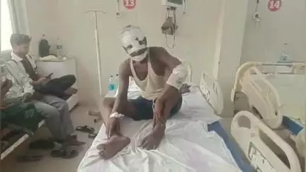 सफीपुर: सफीपुर के माँखी थाना क्षेत्र के बरवट पुर कंजौरा गांव में पेशाब के लिए उठे युवक की छत से गिरने से चोट, इलाज जारी