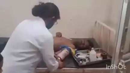 निवास: ग्राम मोहपानी में पुल से गिरा बाइक सवार युवक, प्राथमिक उपचार के बाद जबलपुर रेफर