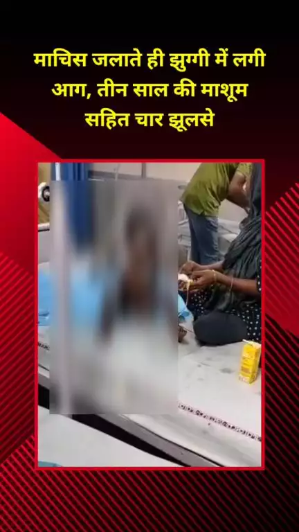 सीलमपुर: सीलमपुर में माचिस जलाते ही झुग्गी में लगी आग, 3 साल की मासूम समेत 4 झुलसे