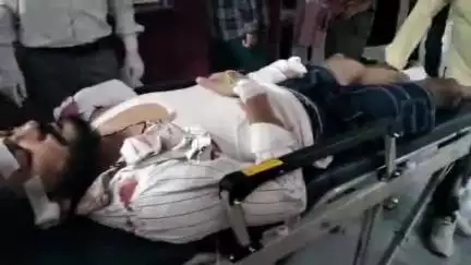 मुरादाबाद: सिविल लाइंस थाना क्षेत्र में दो बाइकों की भिड़ंत में एक बाइक सवार घायल