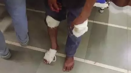 ગોધરા: કોટડા ખાતે બે બાઈક વચ્ચે અકસ્માત સર્જાતા બાઈક પર સવાર પિતા પુત્ર ને ઈજાઓ પહોંચી હતી