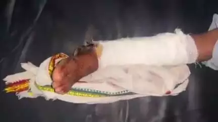 टीकमगढ़: दिनऊ मंदिर के समीप तेज़ रफ़्तार बाइक की टक्कर से 12 वर्षीय बालिका का टूटा पैर, जिला अस्पताल में उपचार जारी