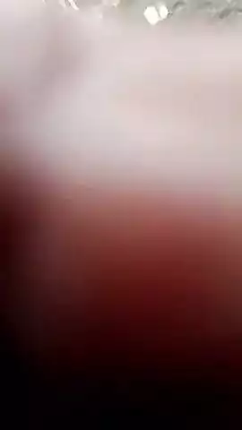 Gandagi se pareshan ho rahe log