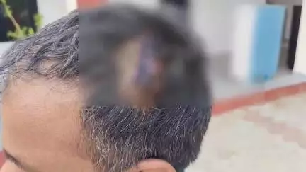 राजगढ़: राजगढ के मोहल्ला नरडिय़ान वार्ड 20 में एक राय होकर मारपीट और घर में घुसकर सामान में तोड़फोड़ करने के आरोप, मामला दर्ज