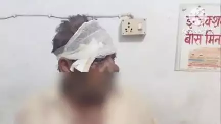 कौंच: ग्राम गुरावती मोड़ के पास तेज रफ्तार बाइक ने आगे जा रही बाइक में मारी टक्कर, दोनों बाइक चालक हुए गंभीर रूप से घायल