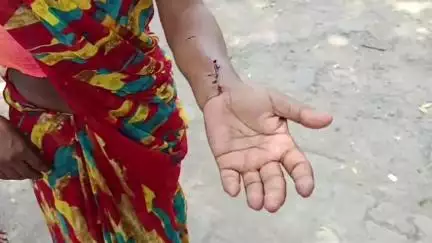 एटा: गांव मरथरा में गली में कूड़ा डालने को लेकर विवाद, मां-बेटी के साथ की गई मारपीट, महिला के कान का कुंडल तोड़ने का आरोप
