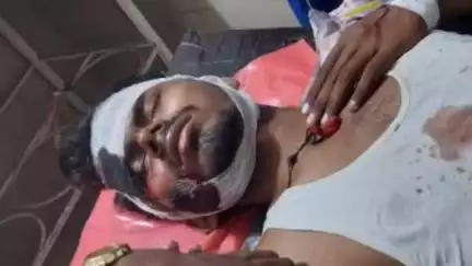 मौदहा: मौदहा क्षेत्र में आमने-सामने दो बाइकों की भिड़ंत में चार बच्चों सहित आधा दर्जन लोग घायल