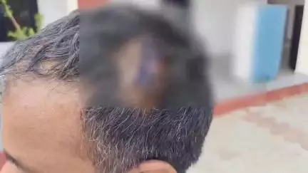 राजगढ़: मोहल्ला नरडियान वार्ड-20 में एक राय होकर मारपीट व घर में घुसकर तोड़फोड़ करने के मामले में 10 लोगों के खिलाफ केस दर्ज