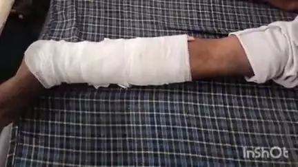 बिजनौर: मंडावर कस्बे के मंगल बाजार में अनियंत्रित बाइक से गिरकर एक युवक हुआ घायल