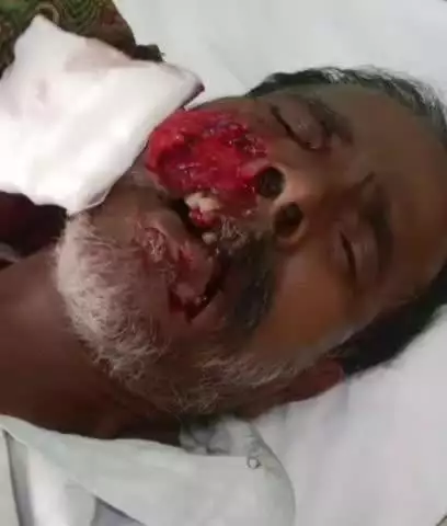 అలంపూర్: వల్లూరు గ్రామంలో పిచ్చికుక్క స్వేర విహారం, ఆరుగురికి గాయాలు