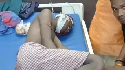 गोड्डा: सैदापुर का युवक सड़क दुर्घटना में घायल, गोड्डा सदर अस्पताल में इलाज जारी