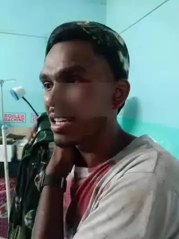 कवर्धा: मिलन चौक बोडला में तेज रफ्तार का कहर, दो बाइक की आपस में जबरदस्त टक्कर, दो युवक गंभीर रूप से घायल