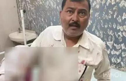 अकोट: मच्छी साथ येथे बस दुचाकीचा अपघात; दुचाकी चालकाचा हात चिरडला गेल्याने गंभीर जखमी