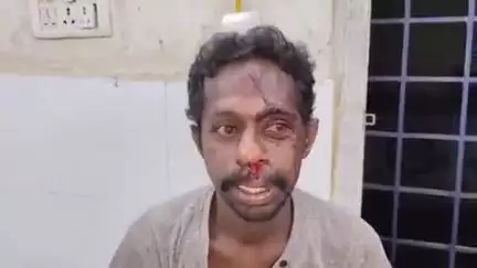 నగర శివారులో ఆటో అదుపు తప్పి బోల్తా, డ్రైవర్‌కు గాయాలు