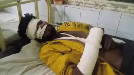 अशोक नगर: बाल्मीकी मोहल्ले में बाइक फिसलने से 19 वर्षीय युवक गंभीर घायल, अस्पताल में इलाज जारी