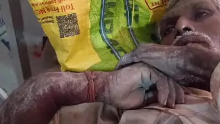 पडरौना: दोघरा शेखवापट्टी में जमीन विवाद को लेकर दबंगों ने महिलाओं को बेरहमी से मारा-पीटा, युवती की हालत गंभीर
