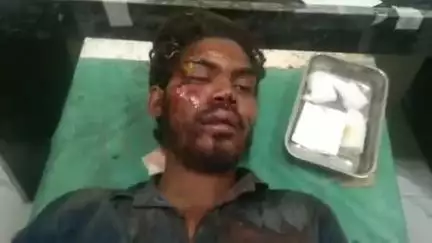 बनेड़ा: बनेड़ा रोड पर अचानक पशु के आने से बाइक सवार युवक अनियंत्रित होकर पशु से टकराया, घायल जिला चिकित्सालय में भर्ती