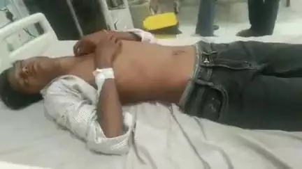 भीलवाड़ा: सदर थाने के समीप अज्ञात वाहन ने बाइक को मारी टक्कर, बाइक सवार दो युवक घायल, जिला अस्पताल में कराया भर्ती
