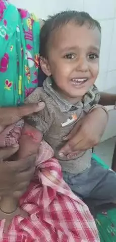 बोराम: पटमदा व बोङाम में कुत्तों का आतंक, पटमदा में आवारा कुत्ते ने एक बच्चे को काटा