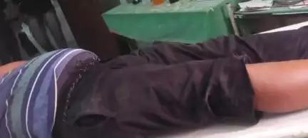 छतरपुर: छतरपुर चेकनेका के पास बाइक सवार ने स्कूटी सवार को मारी टक्कर, स्कूटी सवार जख्मी