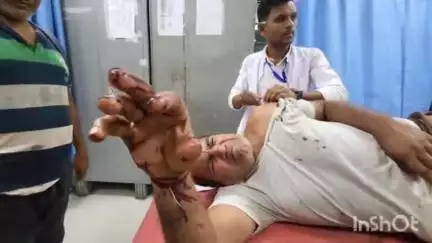 जहानाबाद: आवारा कुत्ते ने एक व्यक्ति पर किया जानलेवा हमला, परिजनों के पहुंचने पर बची जान, अस्पताल में भर्ती