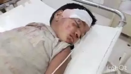 कायमगंज: गांव पुराना गनीपुर निवासी 5 वर्षीय बालक 2 मंजिला मकान की छत से गिरकर घायल, हालत गंभीर