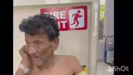 നിലമ്പൂർ: മമ്പാട് വാർത്തിച്ചോല, പാലപറമ്പ് എന്നിവിടങ്ങളിലായി ഉണ്ടായ കാട്ടുപന്നിയുടെ ആക്രമണം 8ഓളം പേർക്ക് പരിക്ക് പറ്റി