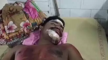 তুফানগঞ্জ ১: দরিয়া বালাই রোড মাকুন্দা ব্রিজ এলাকায় নিয়ন্ত্রণ হারিয়ে স্কুটি নিয়ে পড়ে গিয়ে আহত যুবক ,ভর্তি তুফানগঞ্জ হাসপাতালে