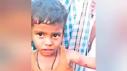 మంత్రాలయం: కౌతాళం మండల కేంద్రంలో ఇంటి ముందు ఆడుతున్న 3 ఏళ్ల  బాలుడి పై కుక్కల దాడి