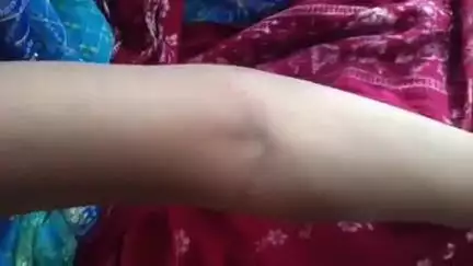 पीपलदा: इटावा कस्बे में बाइपास रोड पर स्थित मकान पर महिला को सांप ने काटा, MBS अस्पताल में भर्ती, उपचार जारी
