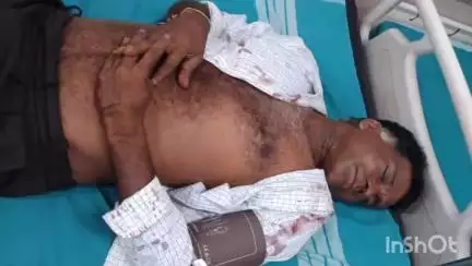 ಸಾಗರ: ಕ್ವಾರಿ ನಿಲ್ಲಿಸಿ ಎಂದಿದ್ದಕ್ಕೆ ದುಷ್ಟರ ದುಷ್ಕೃತ್ಯ! ಐಗಿನಬೈಲು-ಹೊಸೂರು ಬಳಿ ವ್ಯಕ್ತಿಯನ್ನ ಅಡ್ಡಗಟ್ಟಿ ಮಾರಣಾಂತಿಕ ಹಲ್ಲೆ