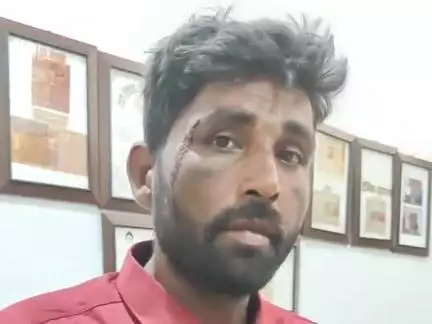 धनौरा: गजरौला के गांव दारानगर में मामूली विवाद के चलते युवक पर किया हमला, घायल थाने पहुंचा