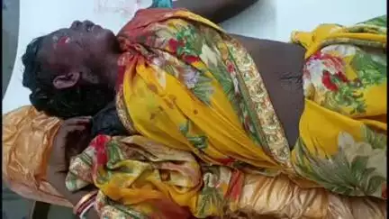 କୋରେଇ: କୁଆଖିଆ ଥାନା ସାହାପୁର ବ୍ରିଜ ଉପରେ ଅଜଣା ଗାଡି ଧକ୍କାରେ ବୃଦ୍ଧା ଗୁରୁତର,ଚିକିତ୍ସା ପାଇଁ ସ୍ଥାନୀୟ ସ୍ୱାସ୍ଥ୍ୟ କେନ୍ଦ୍ରରେ ଭର୍ତ୍ତି