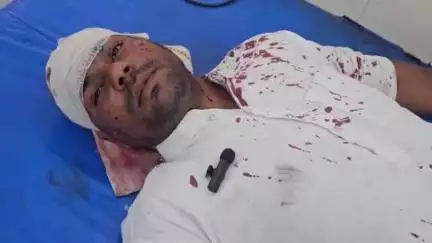 स्वार: स्वार नगर में दबंगों ने मामूली बात पर मारपीट कर दो लोगों को किया घायल, पीड़ितों ने पुलिस से कार्रवाई की मांग की