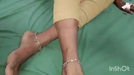 कायमगंज: गांव नानकार नगला की 16 वर्षीय किशोरी को सांप ने काटा, हालत बिगड़ी