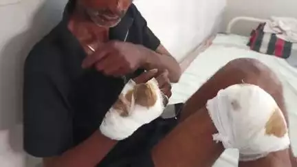 पन्ना: ज़िले में NH-39 पर बाइक के अनियंत्रित होकर गिरने से दंपति व उसका बच्चा हुआ घायल, सड़क पर पड़े गड्ढों की वजह से हुआ हादसा