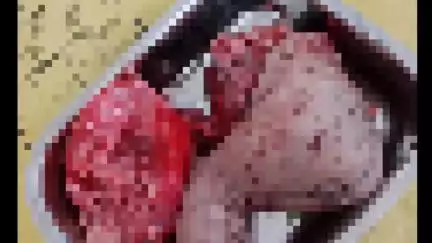 महू: शासकीय अस्पताल में लापरवाही, नवजात को कुत्तों ने खाया, डिलीवरी के बाद महिला फरार