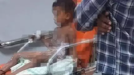 ଅନୁଗୋଳ: ଘୋଡାବାନ୍ଧୁଣି ଗ୍ରାମରେ ଭାତ ହାଣ୍ଡିରେ ପଡ଼ି ନାବାଳକ ଗୁରୁତର