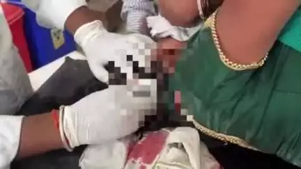 टीकमगढ़: टीकमगढ़: नए बस स्टैंड के पास सड़क हादसे में महिला घायल, सिर में गंभीर चोट, अस्पताल में भर्ती