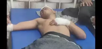 बागपत: दो बाइक की टक्कर में तीन युवक घायल, एक की हालत गंभीर, ग्रामीणों ने ट्रैफिक नियमों के लिए डीएम से की मांग