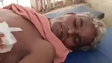 पूर्णिया पूर्व: माधोपारा रुइगोला में मामूली विवाद में बदमाशों ने चलाई गोली, अस्पताल में भर्ती