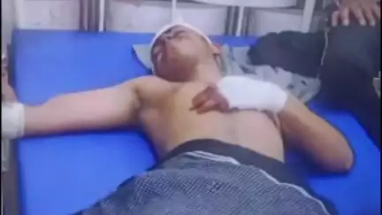 खेकड़ा: ढिकौली-बंथला मार्ग पर रटौल नाले के पास 2 बाइकों की भिड़ंत में 3 युवक घायल, 1 की हालत गंभीर