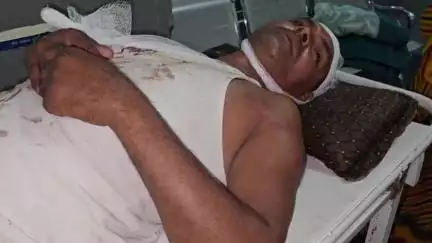 चिचोली: कटकी भाव में पुराने जमीनी विवाद में युवक की आंख में मिर्ची डालकर की गधा कुटाई